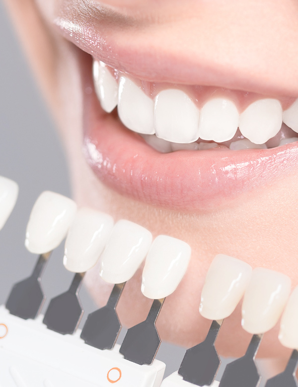 ホワイトニング