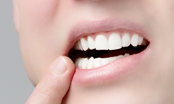 噛み合わせと入れ歯の関係